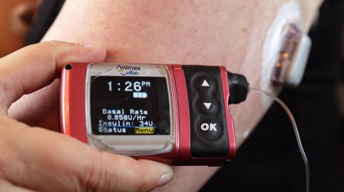 DIABETES: Nå mener et svensk legemiddelselskap at de kan kurere sykdommen for godt.