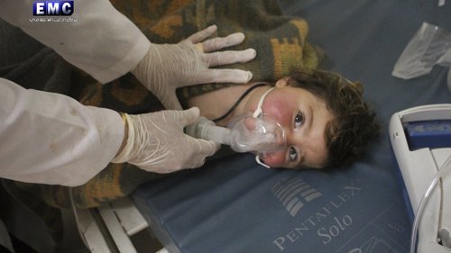 BEHANDLES: Et barn behandles etter det kjemiske angrepet i Khan Sheikhoun 4. april.
