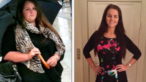 UTROLIG: 22-åringen gikk ned 70 kilo på bare to år.